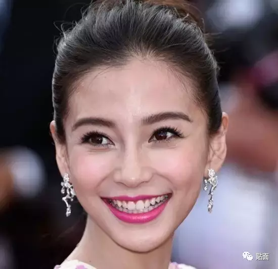 整過牙的明星，背后的故事、觀點大揭秘